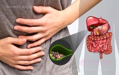 رژیم غذایی سنگ کیسه صفرا