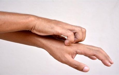 خارش پوست، جدیدترین نشانه ابتلا به ویروس کرونا
