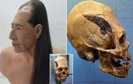 شواهدی از اولین جراحی جمجمه در ۲۰۰۰ سال پیش!