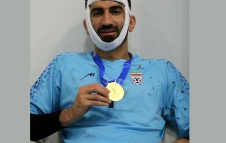 فک دروازه‌بان تیم ملی شکسته است / بیرانوند نیاز جراحی دارد