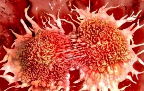 تاثیر مثبت دارویی که احتمال بازگشت سرطان پستان را کاهش می‌دهد