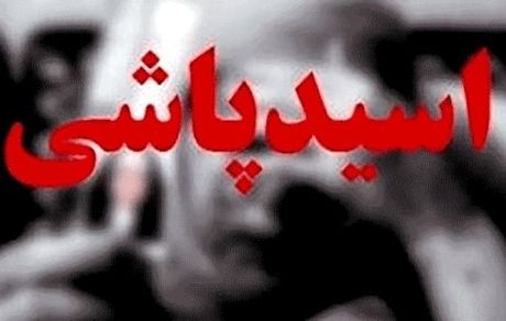 اسیدپاشی بر روی همسر در درگیری خانوادگی