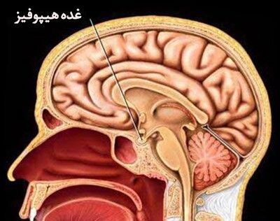 بیماری‌ها و اختلالات غده هیپوفیز