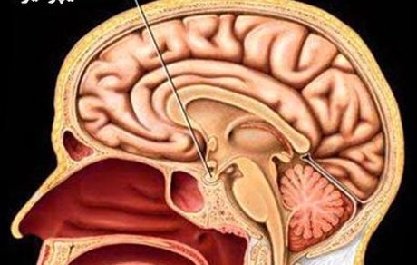 بیماری‌ها و اختلالات غده هیپوفیز