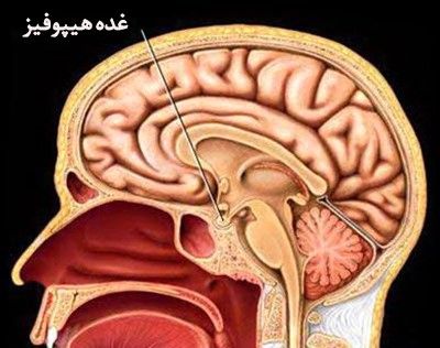 بیماری‌ها و اختلالات غده هیپوفیز