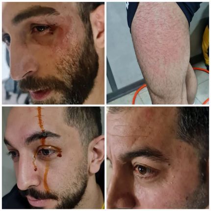 ضرب و شتم بازیکنان و کادرفنی صدرنشین لیگ برتر والیبال در گرگان