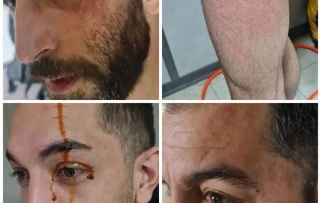 ضرب و شتم بازیکنان و کادرفنی صدرنشین لیگ برتر والیبال در گرگان