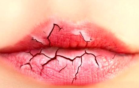 آیا جامعه ایران دچار «بیماری رژ لب» شده است؟
