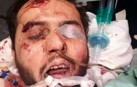 حال عامل حمله تروریستی در حرم شاهچراغ وخیم است