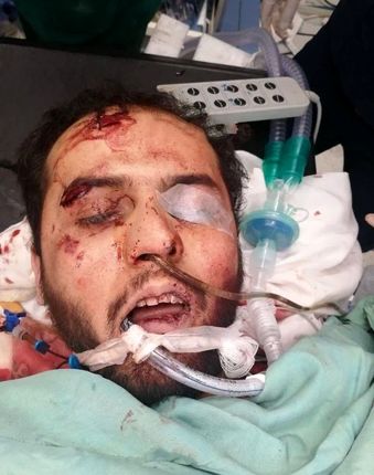 حال عامل حمله تروریستی در حرم شاهچراغ وخیم است