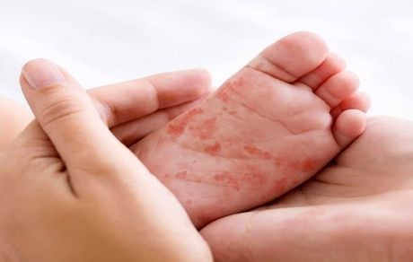 شناسایی بیش از ۳۵۰ هزار بیمار خاص در کشور 