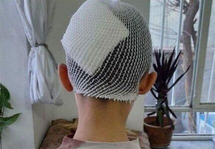 معلم اشنویه‌ای در پی شکستن سر یک دانش‌آموز، به کار خدماتی محکوم شد
