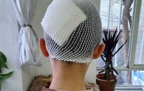 معلم اشنویه‌ای در پی شکستن سر یک دانش‌آموز، به کار خدماتی محکوم شد