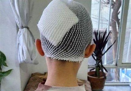 معلم اشنویه‌ای در پی شکستن سر یک دانش‌آموز، به کار خدماتی محکوم شد
