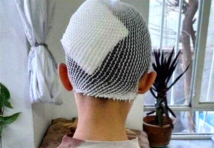 معلم اشنویه‌ای در پی شکستن سر یک دانش‌آموز، به کار خدماتی محکوم شد