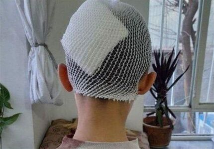 معلم اشنویه‌ای در پی شکستن سر یک دانش‌آموز، به کار خدماتی محکوم شد