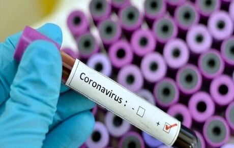 خبر ابتلای ۴۵ نفر به کرونا در کشور صحت دارد؟