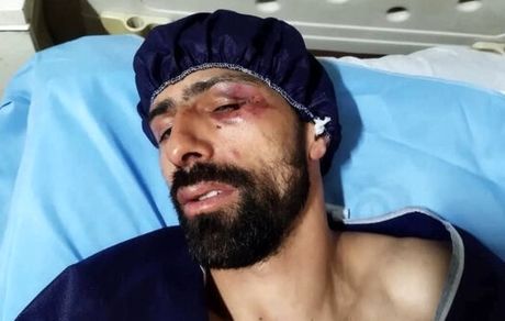ورزشکار المپیکی با سلاح سرد مورد حمله قرار گرفت
