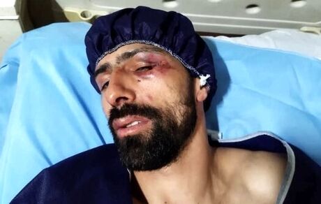 ورزشکار المپیکی با سلاح سرد مورد حمله قرار گرفت