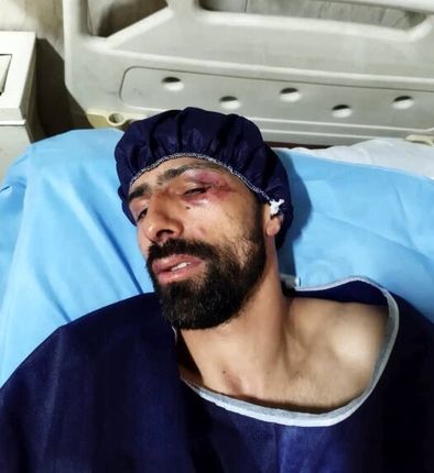 ورزشکار المپیکی با سلاح سرد مورد حمله قرار گرفت