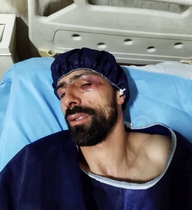 ورزشکار المپیکی با سلاح سرد مورد حمله قرار گرفت