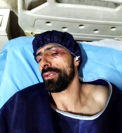 ورزشکار المپیکی با سلاح سرد مورد حمله قرار گرفت