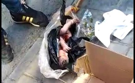 انتقال نوزاد رها شده در سطل زباله به بهزیستی/حال نوزاد خوب است