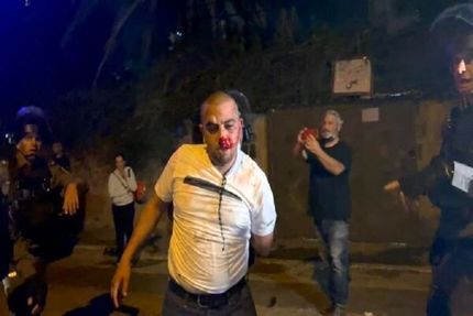 «اینستاگرام» هم اقدام خصمانه «توئیتر» علیه فلسطینیان را تکرار کرد