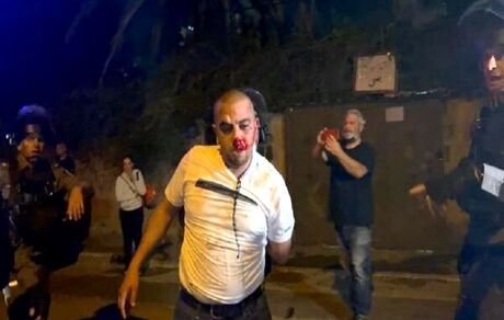 «اینستاگرام» هم اقدام خصمانه «توئیتر» علیه فلسطینیان را تکرار کرد