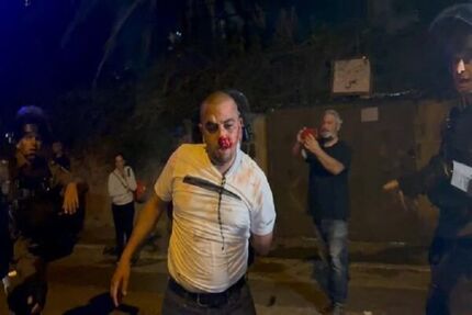 «اینستاگرام» هم اقدام خصمانه «توئیتر» علیه فلسطینیان را تکرار کرد