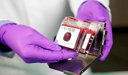 ۲۰۰ هزار نمونه خون بند ناف در کشور ذخیره شده است