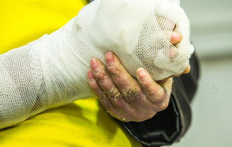 از ۳۷۰ نوع بیماری نادر ۲۲ مورد تحت پوشش وزارت بهداشت هستند