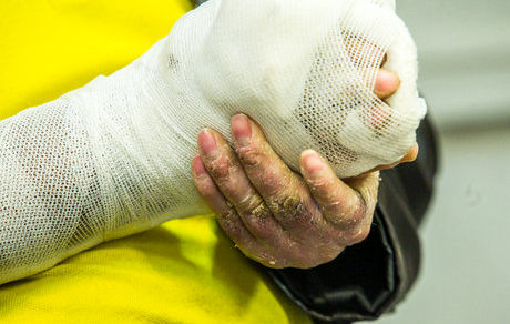 از ۳۷۰ نوع بیماری نادر ۲۲ مورد تحت پوشش وزارت بهداشت هستند