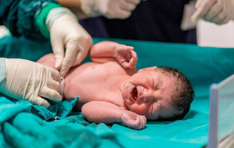 کدام شیوه برای زایمان سزارین بهتر است؟
