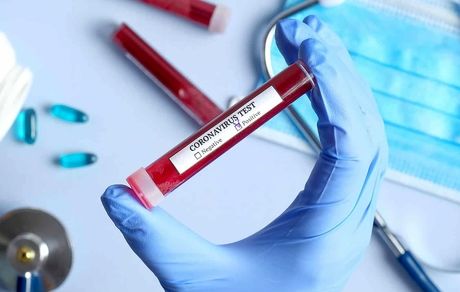 تست کرونا به صورت آنلاین
