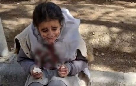 واکنش دادستان اصفهان به ضرب و جرح دختر دانش‌آموز