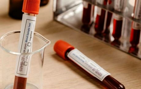 کمتر از ۵۰ نفر در جهان «خون طلایی» دارند