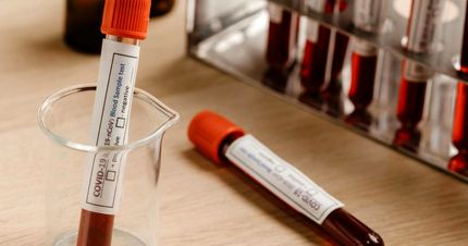 کمتر از ۵۰ نفر در جهان «خون طلایی» دارند