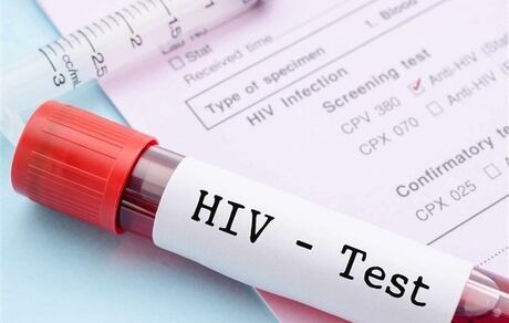از بین بردن ویروس HIV از سلول‌های آلوده ممکن شد