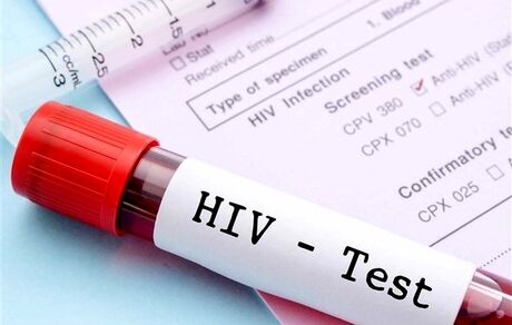 از بین بردن ویروس HIV از سلول‌های آلوده ممکن شد