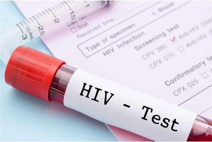از بین بردن ویروس HIV از سلول‌های آلوده ممکن شد