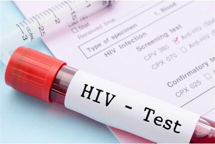 از بین بردن ویروس HIV از سلول‌های آلوده ممکن شد