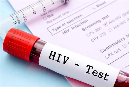 از بین بردن ویروس HIV از سلول‌های آلوده ممکن شد