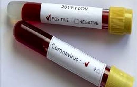 شناسایی ۲ مورد مشکوک به ویروس کرونا در خراسان رضوی