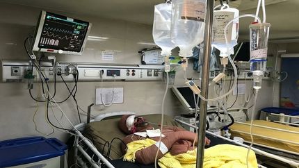 کمبود ۲۰۰۰ تخت سوختگی در کشور 