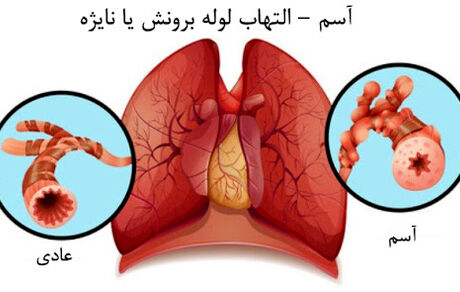 آسم را جدی بگیرید