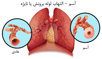 آسم را جدی بگیرید