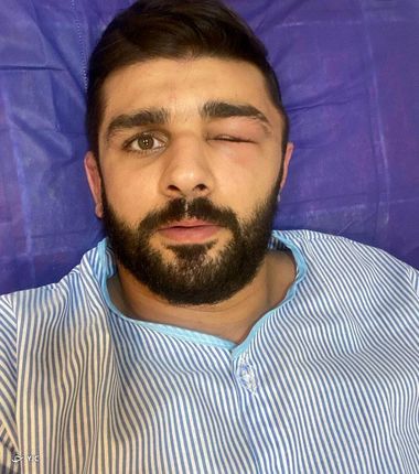 کشتی‌گیر تیم ملی در بیمارستان بستری شد