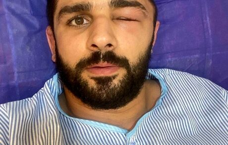 کشتی‌گیر تیم ملی در بیمارستان بستری شد