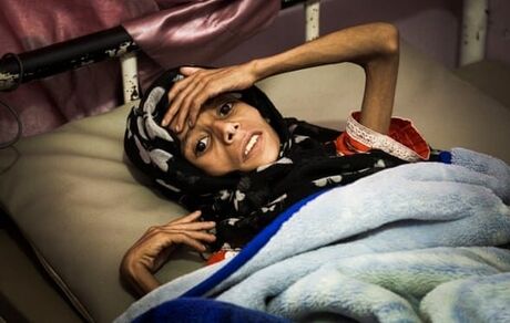 بیش از ۲ هزار زن در یمن قربانی تجاوزات ائتلاف سعودی شده‌اند